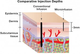 008_Comp_INjection_Depths