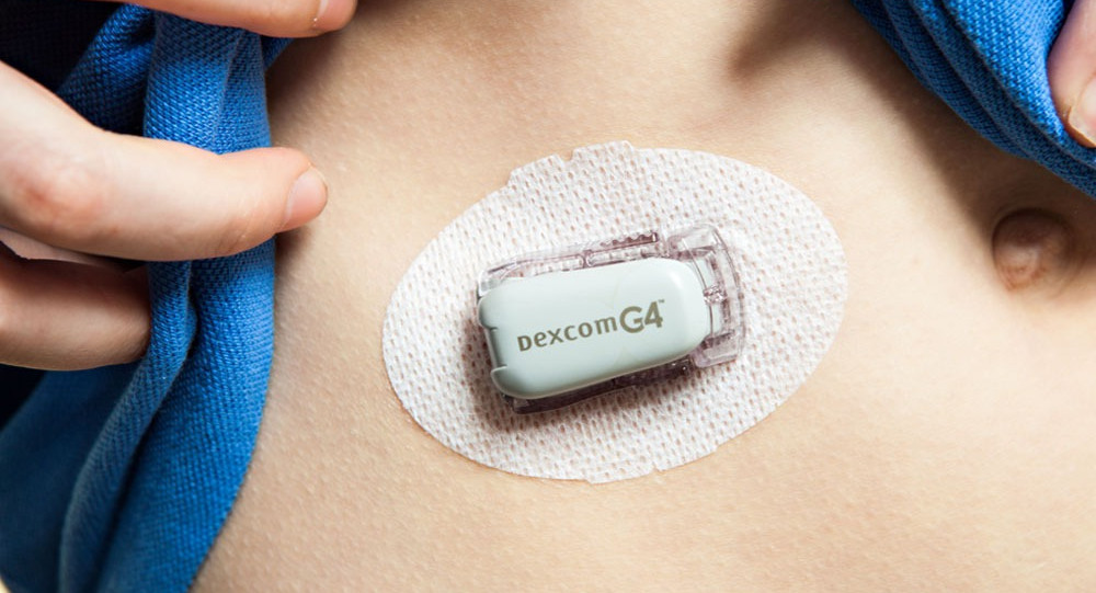 rationalisierung-kalligraphie-status-continuous-glucose-monitoring