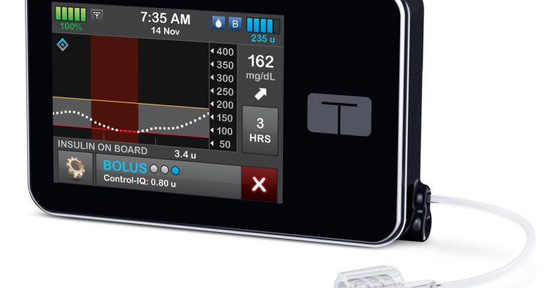 Tandem Diabetes X2 Insulin Pump with Control IQ